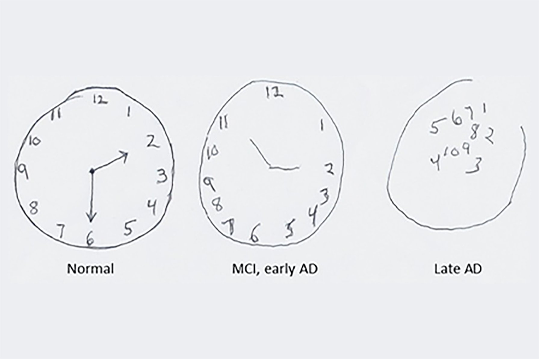 History of the Clock Drawing Test and the Linus Health Platform